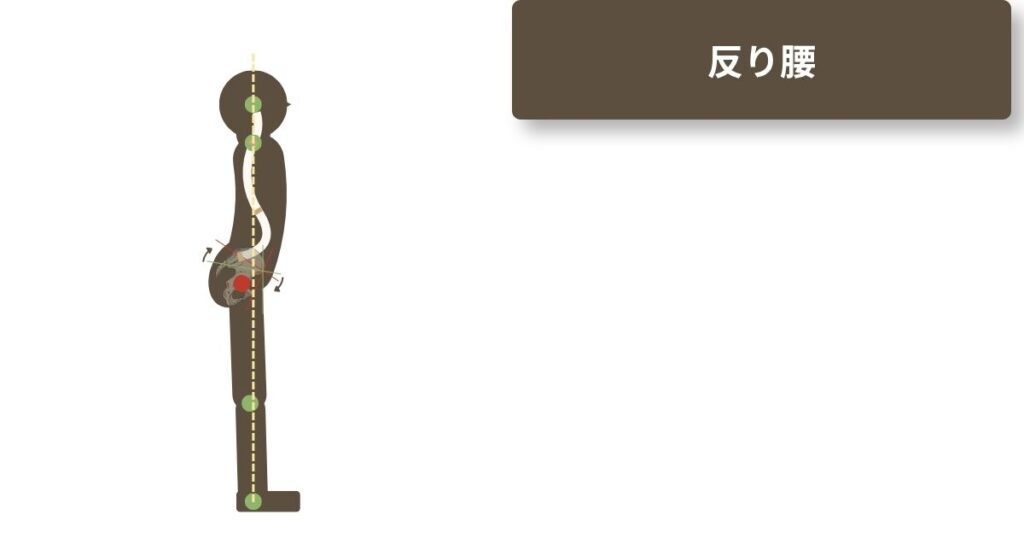 反り腰の参考図。股関節が基準線より後方に。腰がそってお尻が突き出ているように見える。