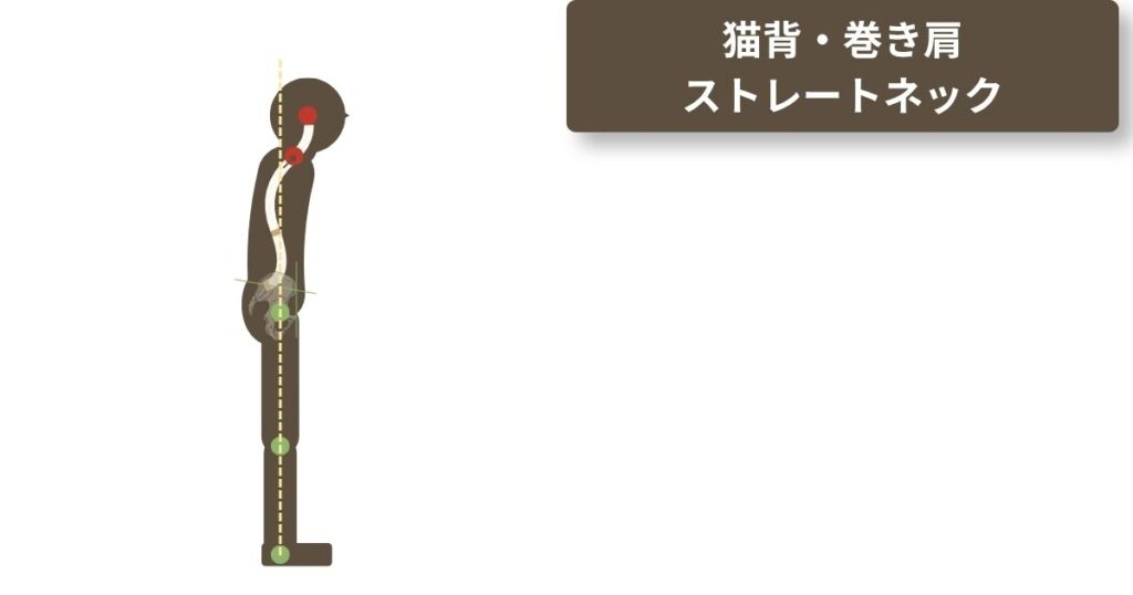 猫背・巻き肩・ストレートネックの参考図。肩が前方向に浮き、肩甲骨が開き、顎が前方に突き出る。