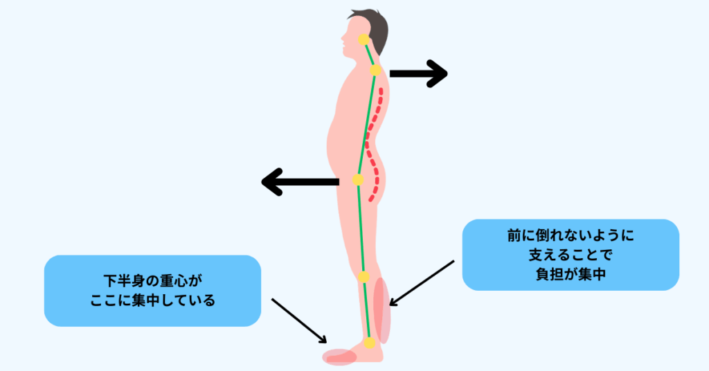 つま先重心・スウェイバック姿勢とふくらはぎへの負担