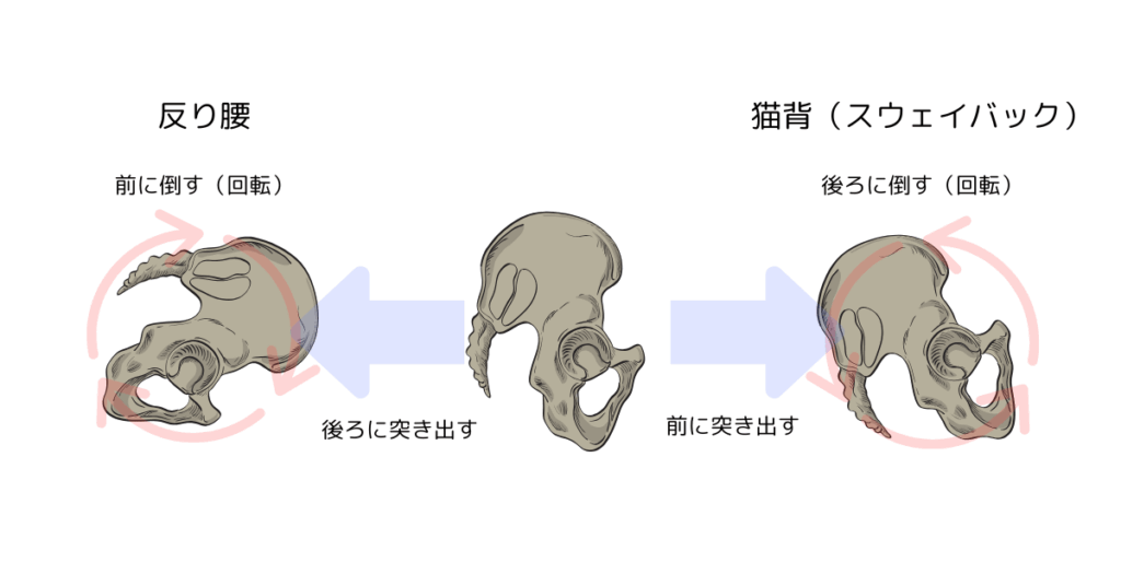 骨盤の傾き（倒す・起こす）・回転と移動（前後に突き出す）の違い。
反り腰→前傾＋後ろに突き出す。
猫背→後傾＋前に突き出す。