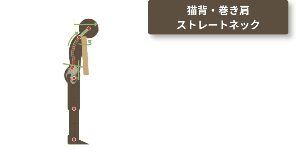 頭が前に出る姿勢から巻き肩・猫背・ストレートネックへつながる崩れの連鎖を一人の人物で示した図。
