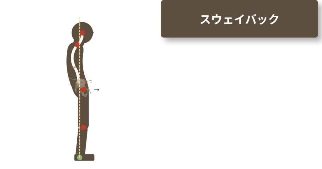 スウェイバックの参考図。重心が傾くことで骨盤が前方に。上半身でバランスを取ろうとすることで、反っているようにみえるが、上半身だけでみると丸まっている。