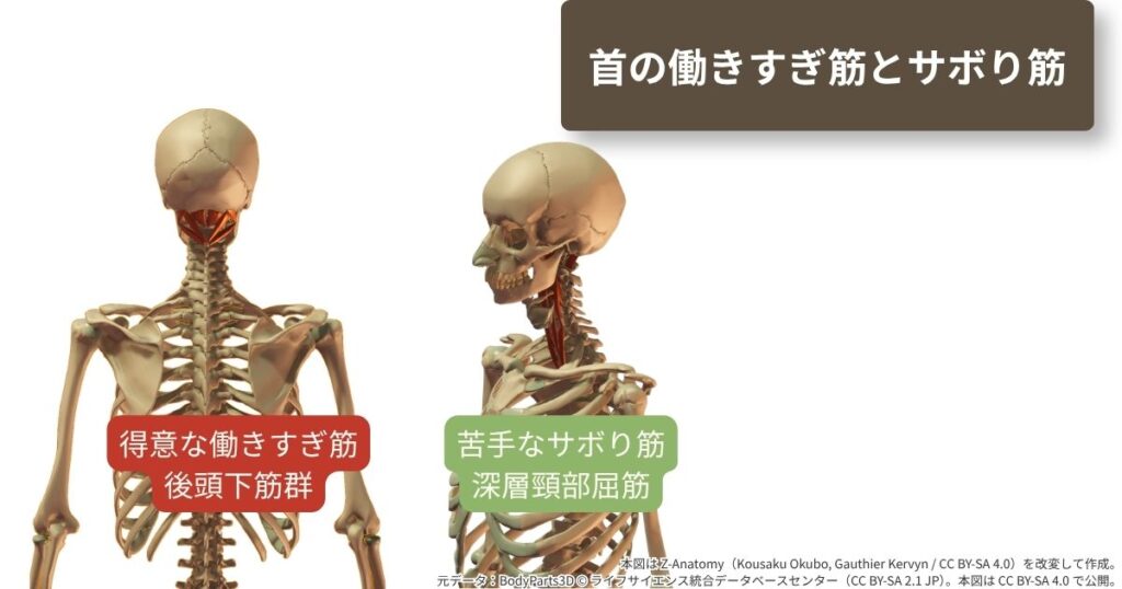 首の後ろ上で縮んで働きすぎる後頭下筋群と、首の奥で眠っている深層頸部屈筋を示した図