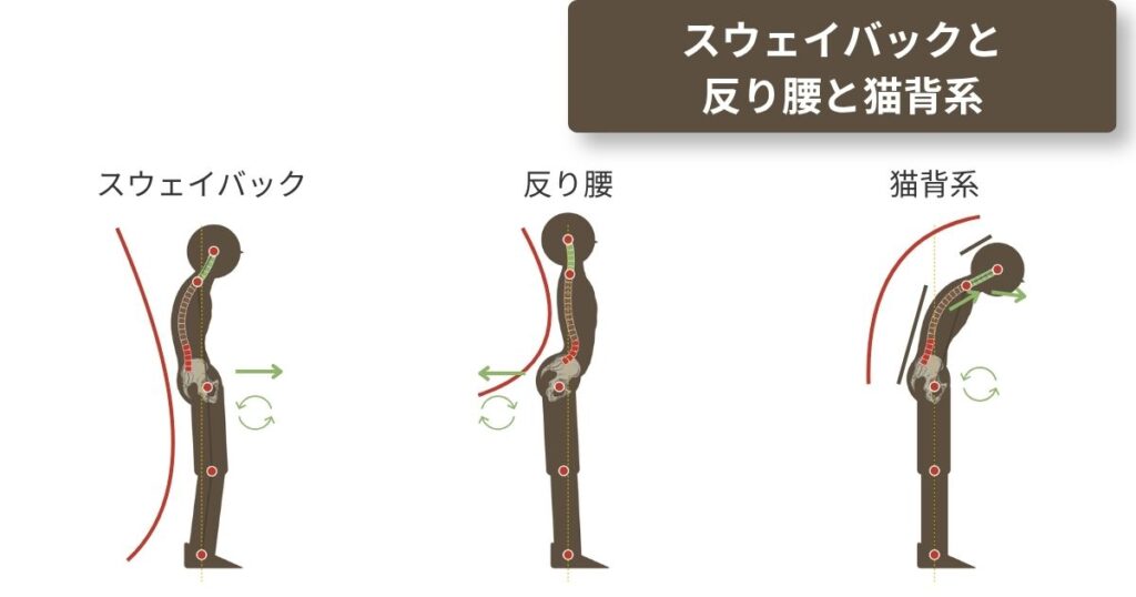 スウェイバック・反り腰・猫背系(猫背・巻き肩・ストレートネック・フラットバック)の比較図。