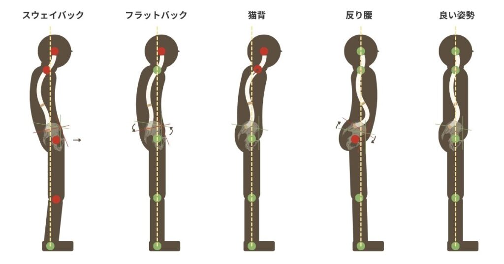 悪い姿勢と良い姿勢の比較図。スウェイバック・フラットバック・猫背・反り腰・良い姿勢の人が並んで立っている。